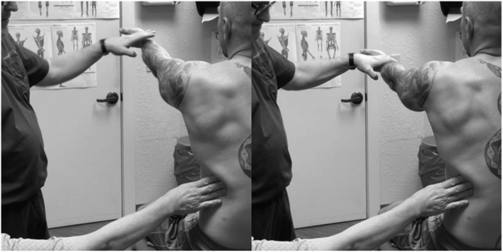Biotensegrity-informed Speed’s test in supination
