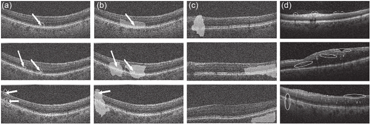 Example of misclassified images