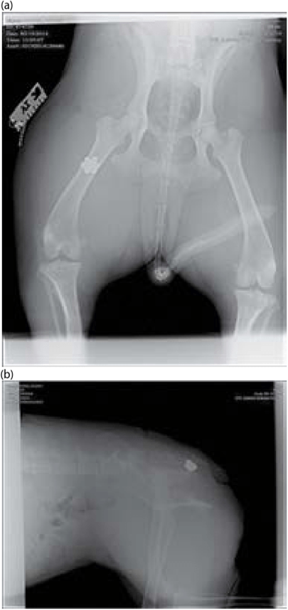 (a,b) V/D and lateral radiographs of gunshot wound to the thigh