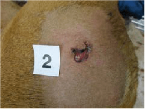 Exit wound; notice outward protruding of the tissue flap