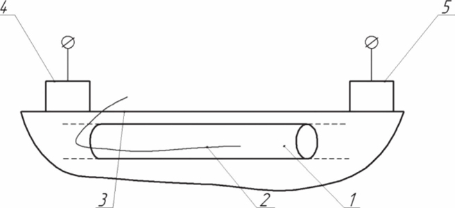 Scheme of direct electrochemical oxidation of blood. 1, blood vessel; 2, wire electrode; 3, skin covering; 4 and 5, applicator electrodes